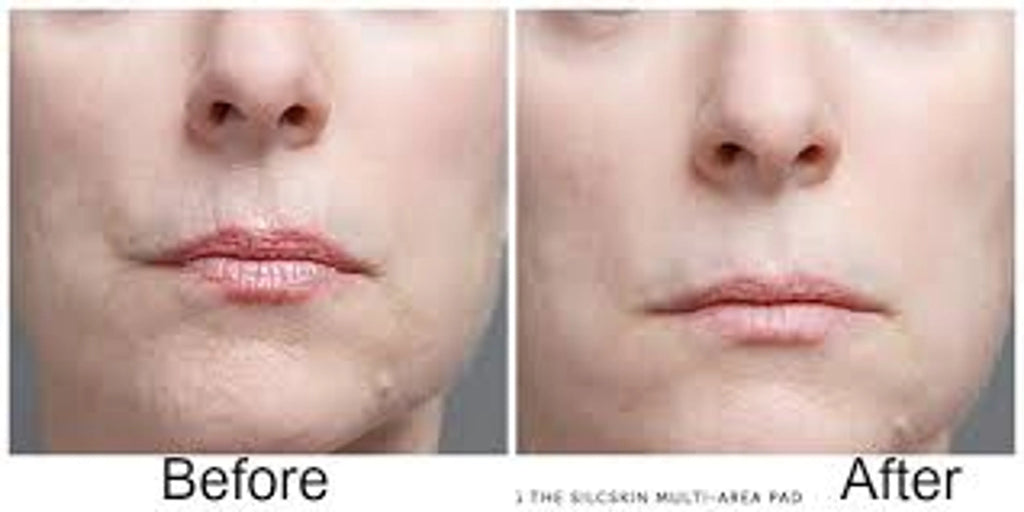 Skin Plumping Reusable Mouth & Lip Treatment Pad