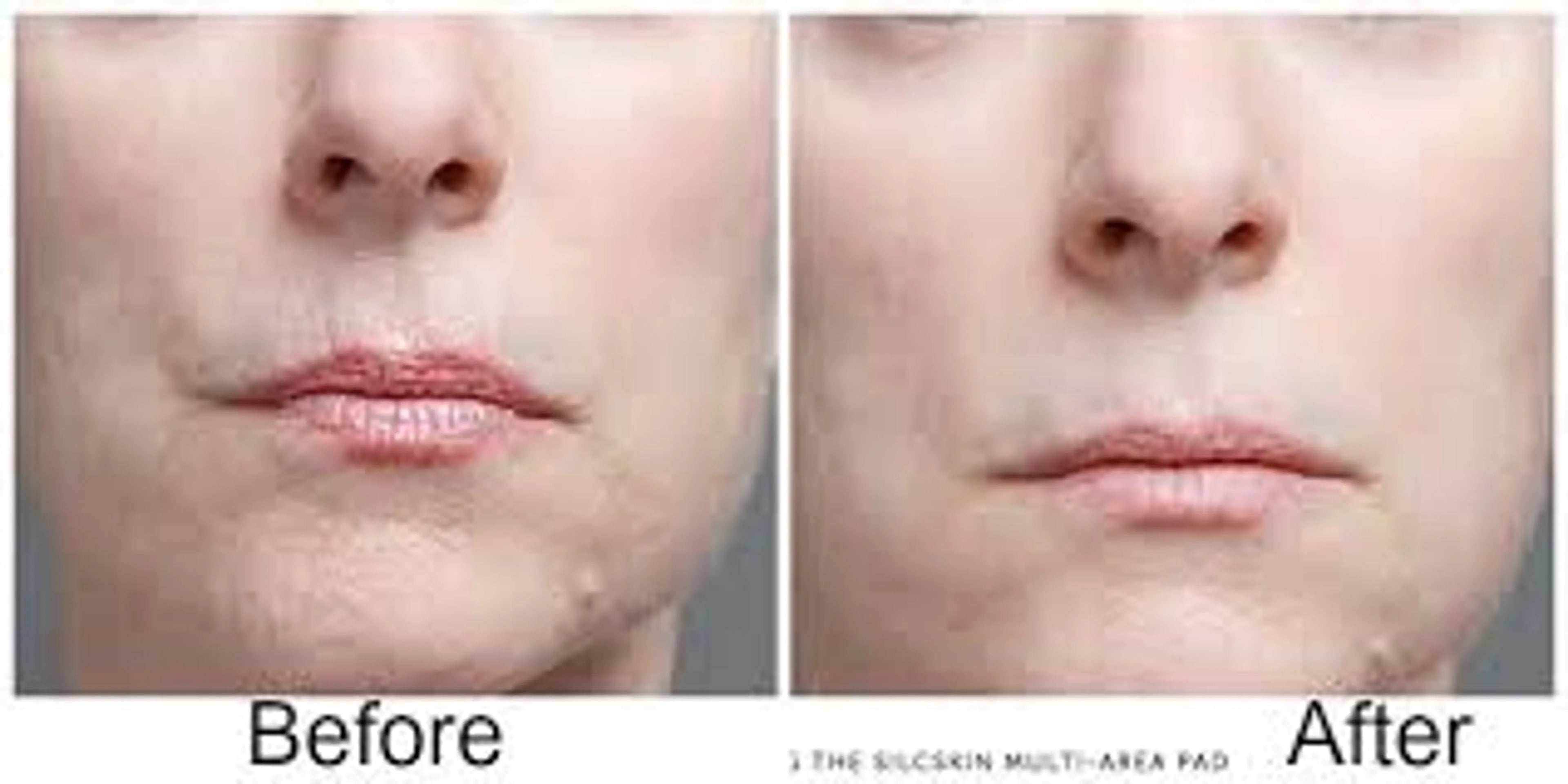 Skin Plumping Reusable Mouth & Lip Treatment Pad