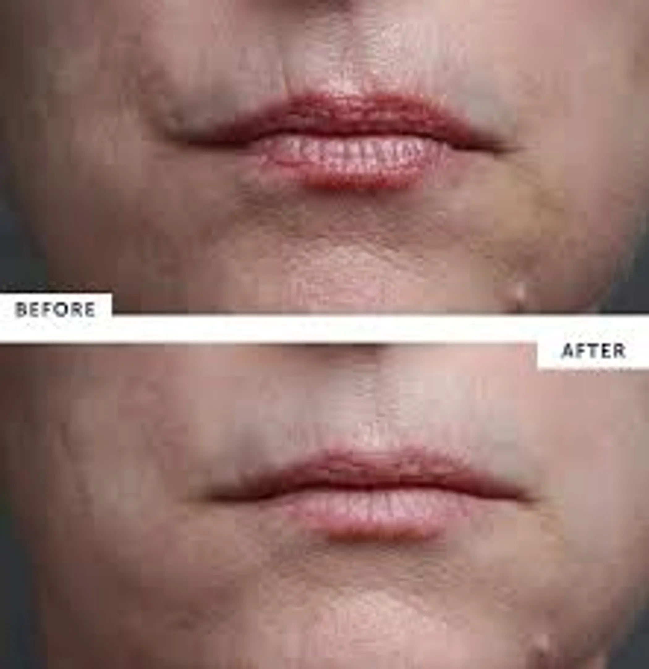Skin Plumping Reusable Mouth & Lip Treatment Pad